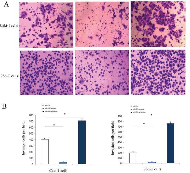 Invasive ability of of RCC cells transfected with miR-338-3p miR-338-3p mimic or inhibitor examined by Transwell assay.