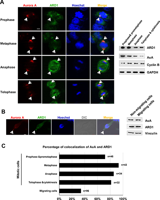Aurora kinase A colocalalizes with ARD1 during cell division and cell migration.