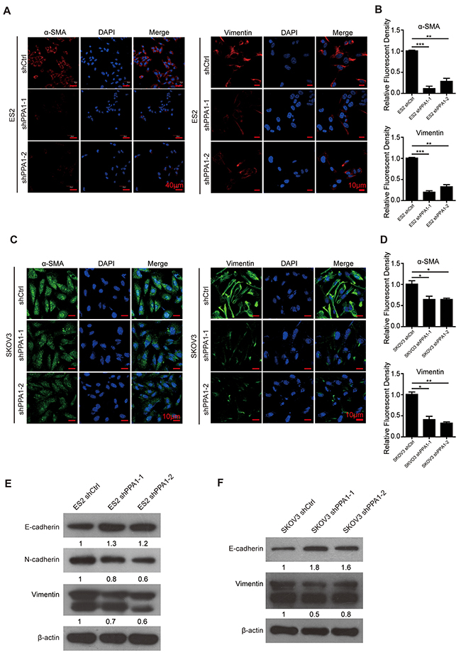 Silencing PPA1 induced reversion of EMT in EOC cells.