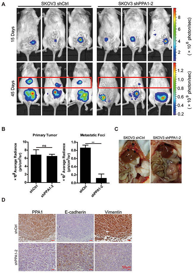 PPA1 in SKOV3 cells accelerating tumor cell metastasis in mouse tumor xenografts in vivo.