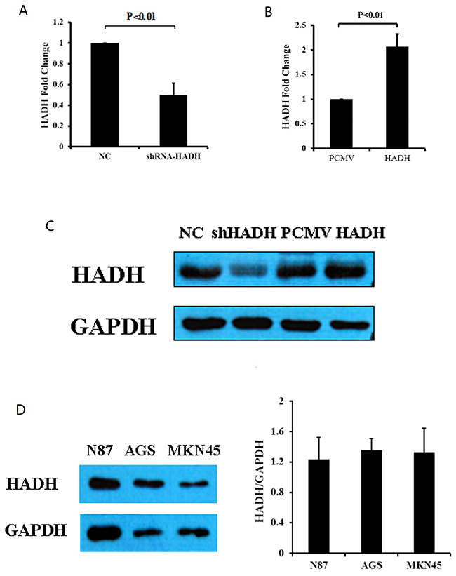 HADH expression in gastric cancer lines.