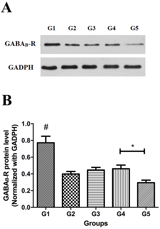 Western blot analysis of GABAB receptor protein in spinal cord (L5) in all groups.