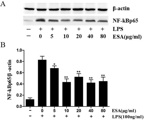 Effect of TgESAs on the activation of NF-kB, detected by Western blotting.