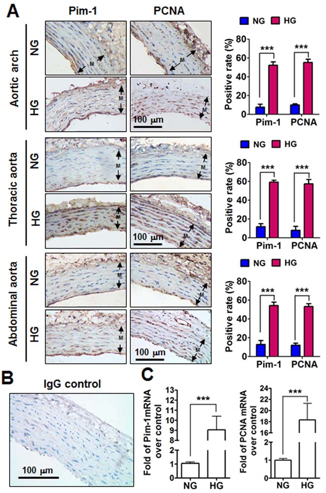 Pim-1 and PCNA expression in the tunica media (M) of the aortic arches, thoracic and abdominal arteries of STZ-induced hyperglycemia (HG) and normoglycemia (NG) rats.