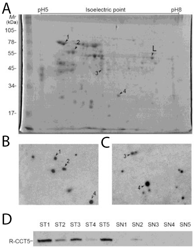 Screening and validation of autoantibodies in NSCLC.