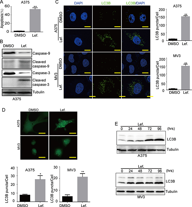 Leflunomide induces apoptosis and autophagy in melanoma cells.