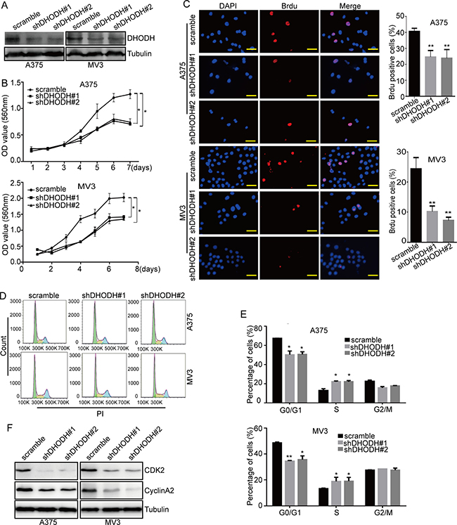 DHODH knockdown suppresses cell proliferation and induces cell cycle arrest at S phase in melanoma cells.