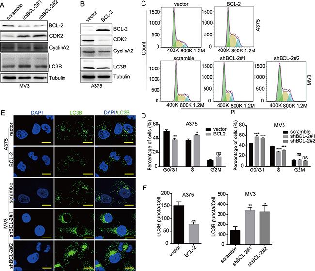 DHODH inhibition-induced cell cycle arrest and autophagy are regulated by BCL-2.