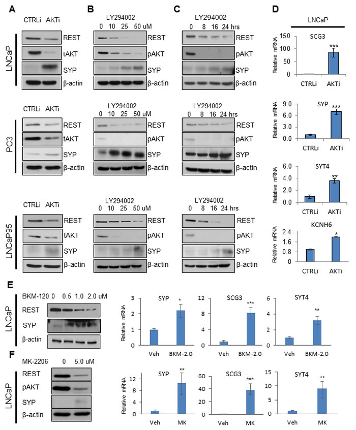 PI3K/AKT inhibition reduces REST and increases NE markers.