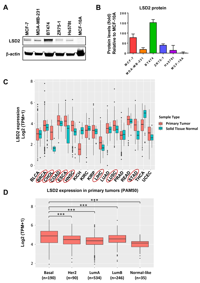 Expression level of LSD2 in breast cancer cell lines and clinical tumor specimens.