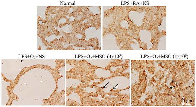 Representative immunohistochemical staining for a human-specific nuclear antigen in lung tissues on postnatal day 14.