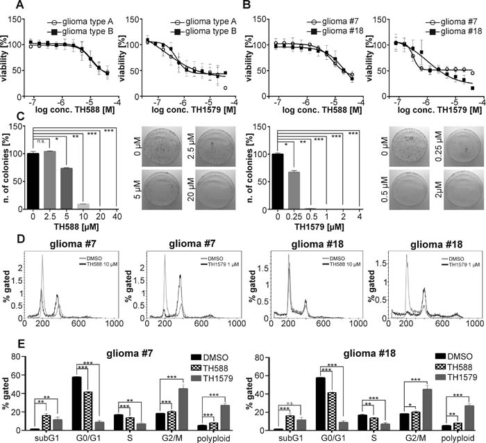 MTH1 inhibitors TH588 and TH1579 target GMB cells independent of aggressiveness.