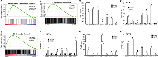 Effects of ML327 on neuroepithelial differentiation.