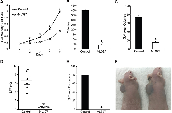 Pretreatment with ML327 blocks neuroblastoma proliferative potential and tumor-initiating capacity.