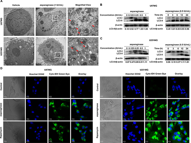 Asparaginase activated autophagy in GBM cells.