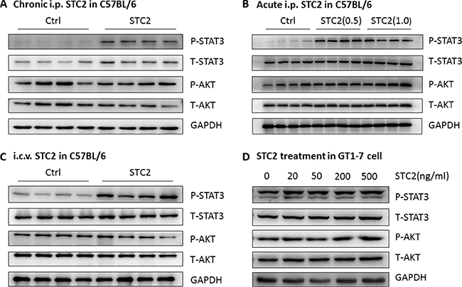 STC2 activates the STAT3 pathway in the hypothalamus and GT1-7 cells.