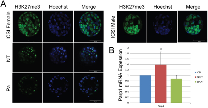 Distribution of H3K27me3 in ICSI and CCNT blastocysts and Real-time quantitative expression of Parp1.