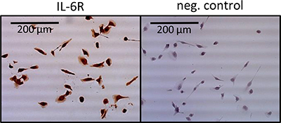 Immunohistochemical staining of IL-6R in 768-O cells.