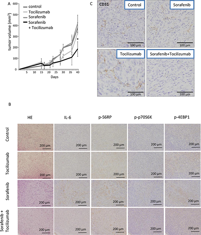 Effect of combination therapy with sorafenib and tocilizumab on a nude mice xenografts model of 786-O cells.