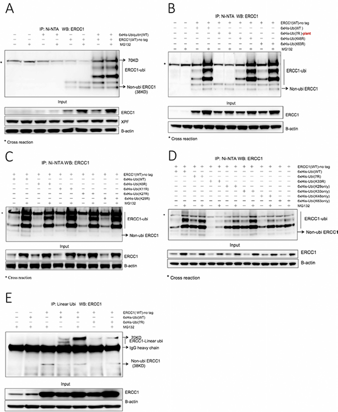 ERCC1 is modified by ubiquitination involving both ubiquitin Lys 33 and linear polyubiquitination.