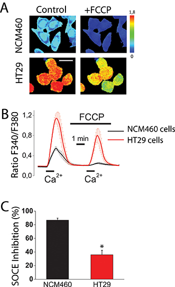 Mitochondria control store-operated Ca2+ entry (SOCE) in normal colonic cells and colon cancer cells.