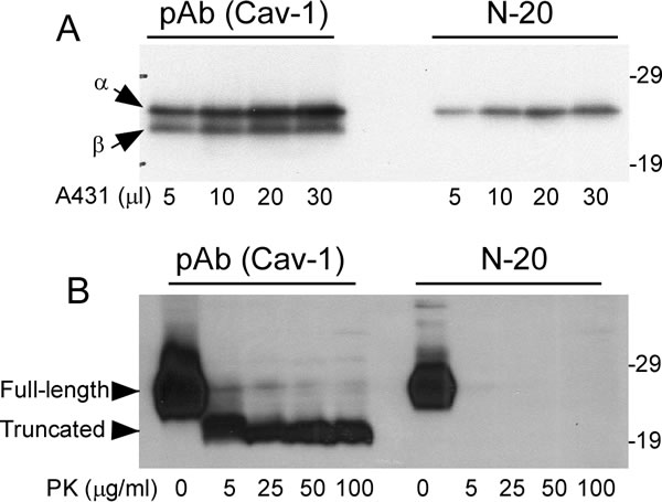 Comparison of PK-sensitive and PK-resistant domains of Caveolin-1 detected with two anti-caveolin-1 antibodies.