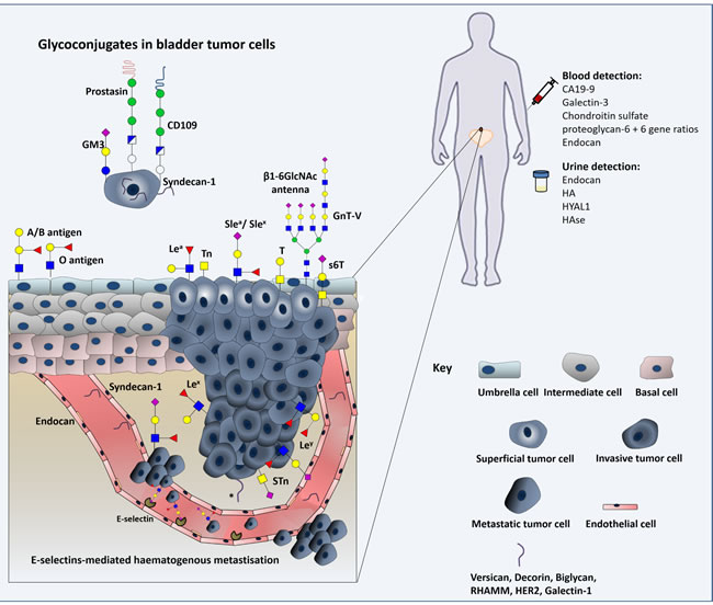 Schematic representation of the glycomolecule-mediated metastization model and diagnostic value of glycans.