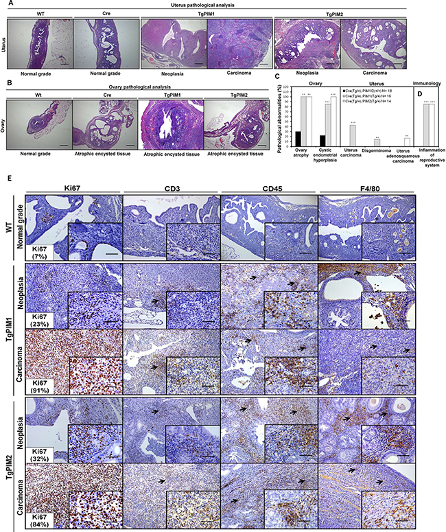 Pathological analysis of the uterus and ovary in TgPIM1/TgPIM2 transgenic models.