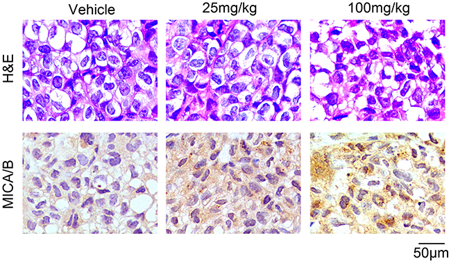 Resveratrol upregulates MICA/B expression in breast cancer xenograft tumors.