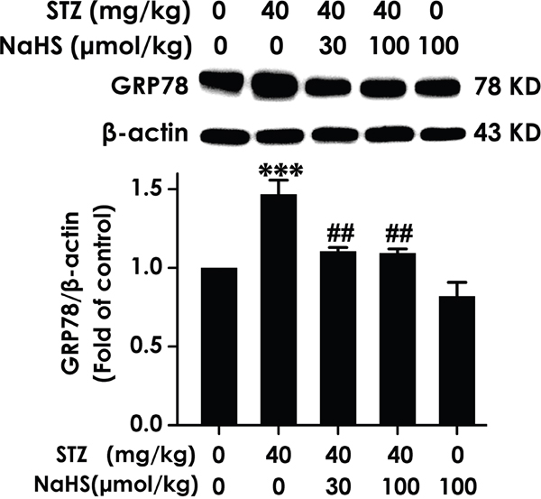 Effect of NaHS on the expression of GRP78 in the hippocampus of STZ-induced diabetic rats.