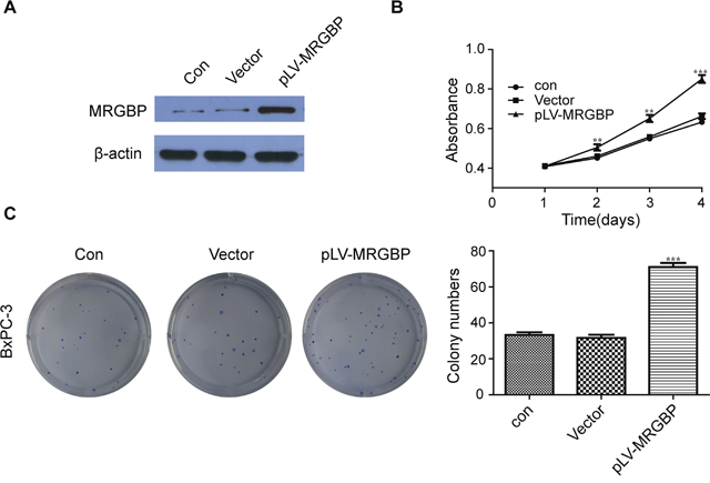 Overexpression of MRGBP promotes PDAC cell proliferation.