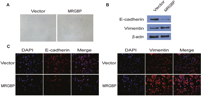 Overexpression of MRGBP induces EMT in PDAC cells.