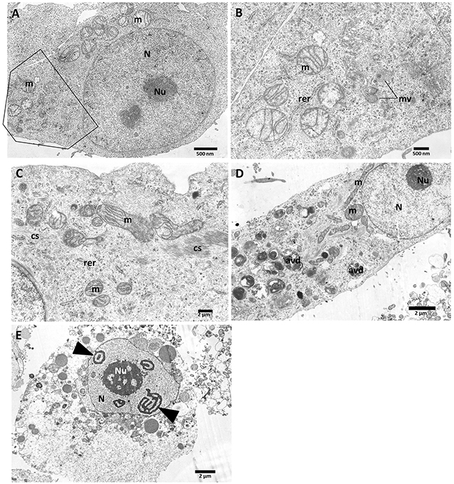 Ultrastructural features of PANC-1 cells incubated with vanadium complexes: C3 and C5 for 48 h.