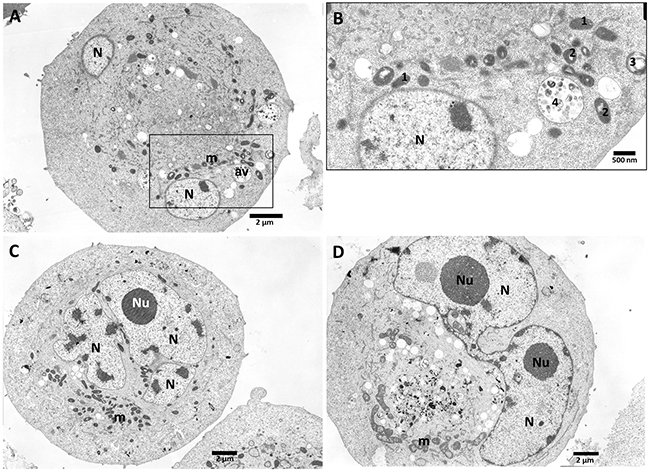 PANC-1 cells treated with vanadium complex C7 (10 &#x03BC;M).