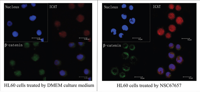 Immunofluorescence staining of ICAT and &#x03B2;-catenin during NSC67657-induced monocytic differentiation.