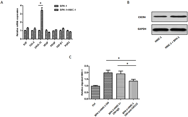 CXCL12/CXCR4 axis is responsible for BPH-1 induced mast cells migration.