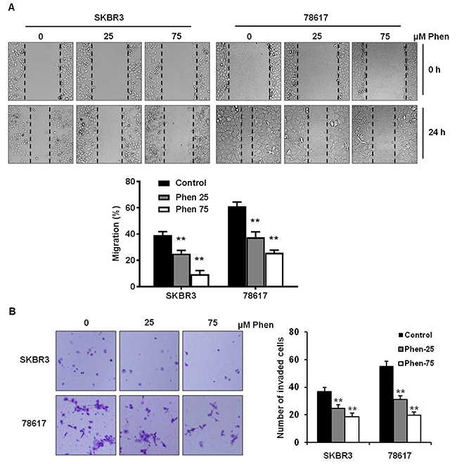 Phenformin inhibits cell migration and invasion in ErbB2-overexpressing breast cancer cells.