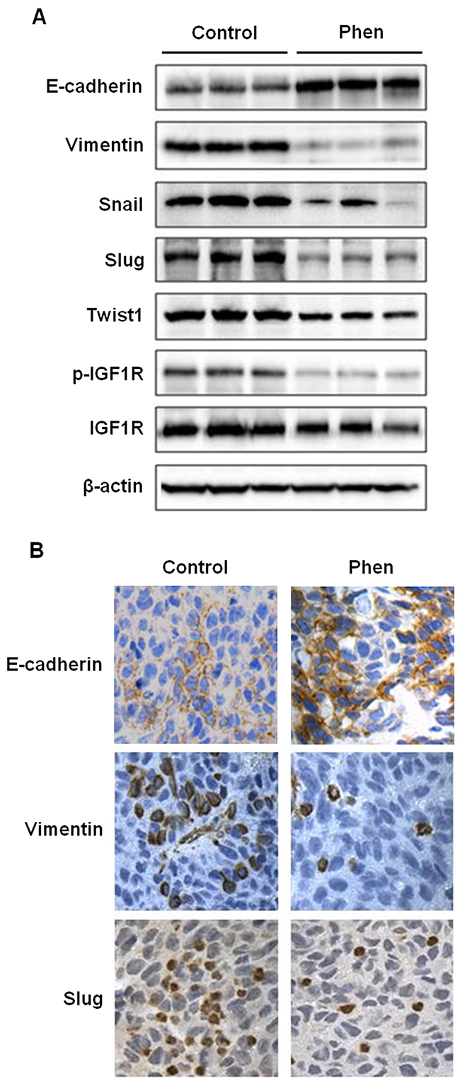 Phenformin inhibits EMT in ErbB2-overexpressing syngeneic tumor graft cells in vivo.