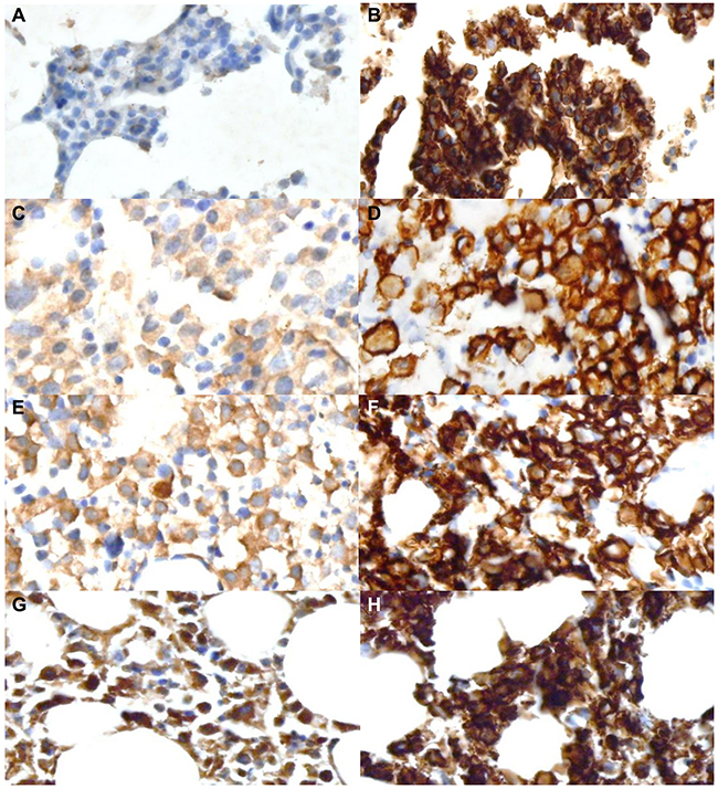Immunohistochemical staining for the V-set Ig domain-containing 4 (VSIG4) and CD138 in representative tissue samples.