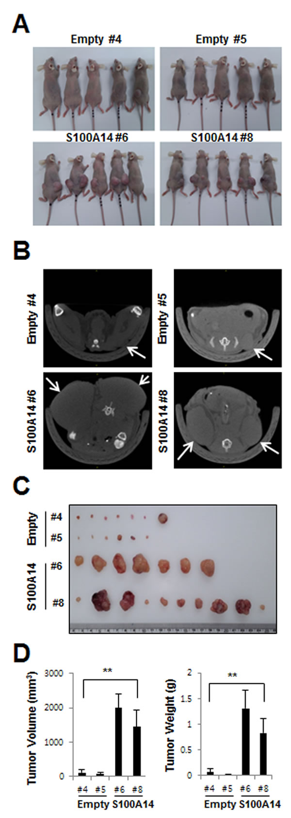 S100A14 overexpression increases in vivo xenograft tumor growth.