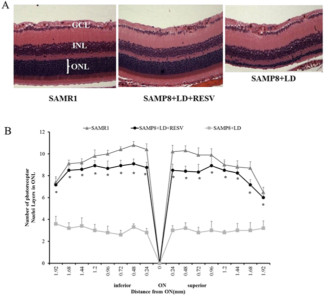 RESV preserved the structure of photoreceptor layer of aged SAPM8 mice that were exposed to light damage.