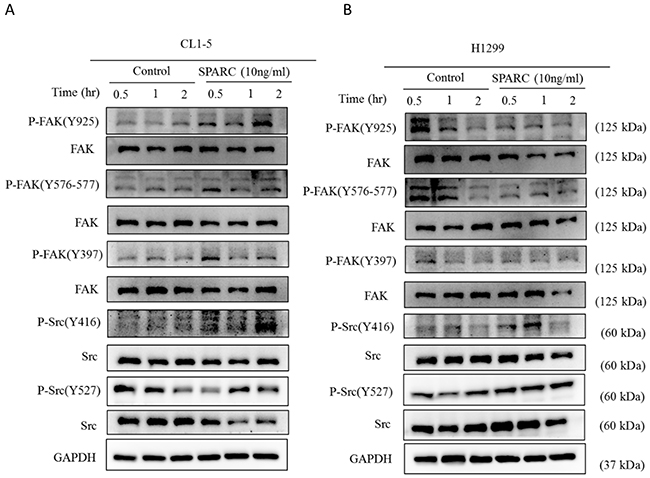 Investigation of FAK and Src signaling pathways after SPARC treatment.