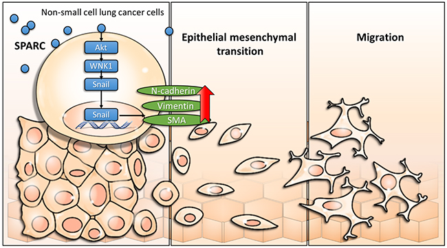 Scheme of proposed exogenous SPARC mediated signaling pathways in non-small cell lung cancer.