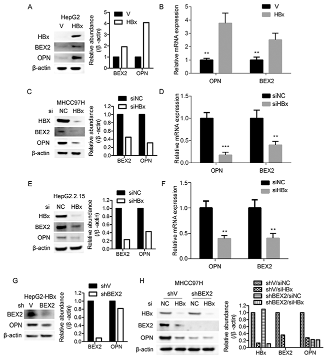 HBx enhances OPN expression via up-regulation of BEX2.