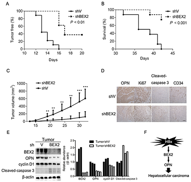Reduction of BEX2 suppresses the tumorigenicity of HCC cells.