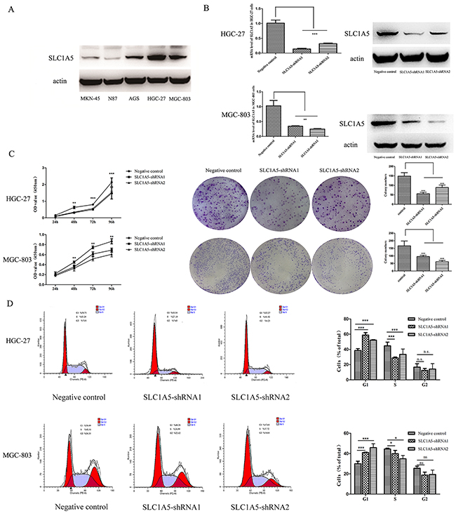 The proliferation-suppressive effect of SLC1A5 knockdown on GC cells.