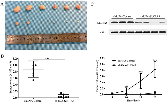 SLC1A5 knockdown suppressed tumor growth in vivo.