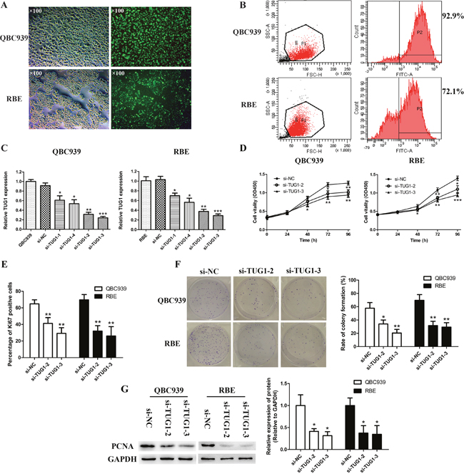 Transfection and knockdown efficiency of TUG1-specific siRNA and TUG1 depletion retarded cell proliferation and colony formation in CCA cells.