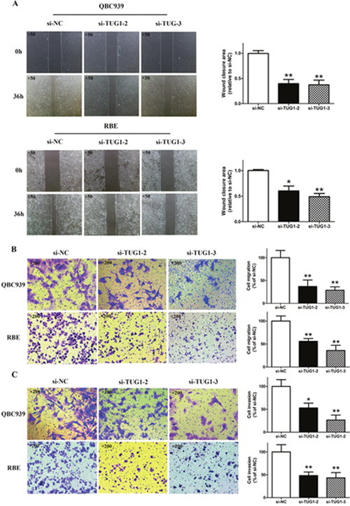 Knockdown of TUG1 inhibited cell migration and invasion potential in CCA cells.