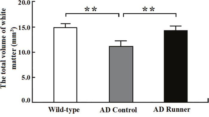 The total white matter volume of the Wild-type, APP/PS1 Control and APP/PS1 Runner mice (mean &#x00B1; SD).